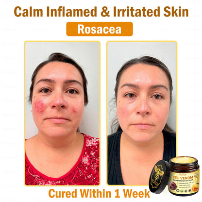 VLSVLS® 🎁🎁🎁𝐎𝐧𝐥𝐲 𝟏𝟎 𝐁𝐨𝐱𝐞𝐬 𝐥𝐞𝐟𝐭! 𝐖𝐞'𝐫𝐞 𝐨𝐟𝐟𝐞𝐫𝐢𝐧𝐠 𝐲𝐨𝐮 𝐚𝐧 𝐚𝐝𝐝𝐢𝐭𝐢𝐨𝐧𝐚𝐥 𝟑𝟎% 𝐝𝐢𝐬𝐜𝐨𝐮𝐧𝐭! 𝐆𝐚𝐢𝐧 𝐠𝐫𝐞𝐚𝐭𝐞𝐫 𝐛𝐞𝐚𝐮𝐭𝐲 𝐚𝐧𝐝 𝐜𝐨𝐧𝐟𝐢𝐝𝐞𝐧𝐜𝐞. 𝐌𝐢𝐬𝐬 𝐨𝐮𝐭 𝐧𝐨𝐰, 𝐚𝐧𝐝 𝐲𝐨𝐮 𝐰𝐨𝐧'𝐭 𝐡𝐚𝐯𝐞 𝐚𝐧𝐨𝐭𝐡𝐞𝐫 𝐜𝐡𝐚𝐧𝐜𝐞 𝐮𝐧𝐭𝐢𝐥 𝐧𝐞𝐱𝐭 𝐲𝐞𝐚𝐫.