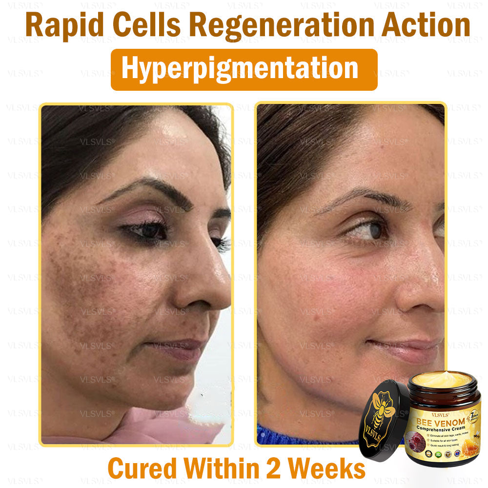 VLSVLS® 🎁🎁🎁𝐎𝐧𝐥𝐲 𝟏𝟎 𝐁𝐨𝐱𝐞𝐬 𝐥𝐞𝐟𝐭! 𝐖𝐞'𝐫𝐞 𝐨𝐟𝐟𝐞𝐫𝐢𝐧𝐠 𝐲𝐨𝐮 𝐚𝐧 𝐚𝐝𝐝𝐢𝐭𝐢𝐨𝐧𝐚𝐥 𝟑𝟎% 𝐝𝐢𝐬𝐜𝐨𝐮𝐧𝐭! 𝐆𝐚𝐢𝐧 𝐠𝐫𝐞𝐚𝐭𝐞𝐫 𝐛𝐞𝐚𝐮𝐭𝐲 𝐚𝐧𝐝 𝐜𝐨𝐧𝐟𝐢𝐝𝐞𝐧𝐜𝐞. 𝐌𝐢𝐬𝐬 𝐨𝐮𝐭 𝐧𝐨𝐰, 𝐚𝐧𝐝 𝐲𝐨𝐮 𝐰𝐨𝐧'𝐭 𝐡𝐚𝐯𝐞 𝐚𝐧𝐨𝐭𝐡𝐞𝐫 𝐜𝐡𝐚𝐧𝐜𝐞 𝐮𝐧𝐭𝐢𝐥 𝐧𝐞𝐱𝐭 𝐲𝐞𝐚𝐫.